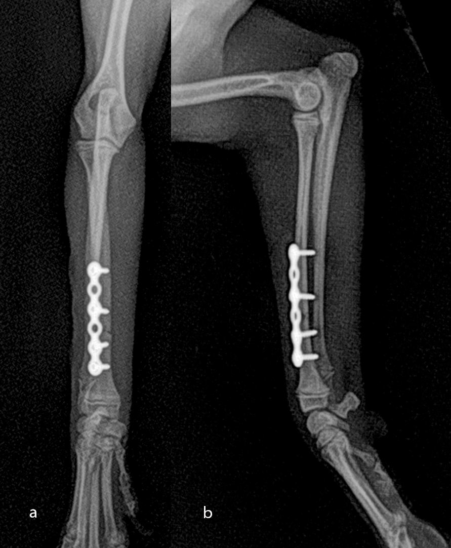 Fig-8 Case 2 post op