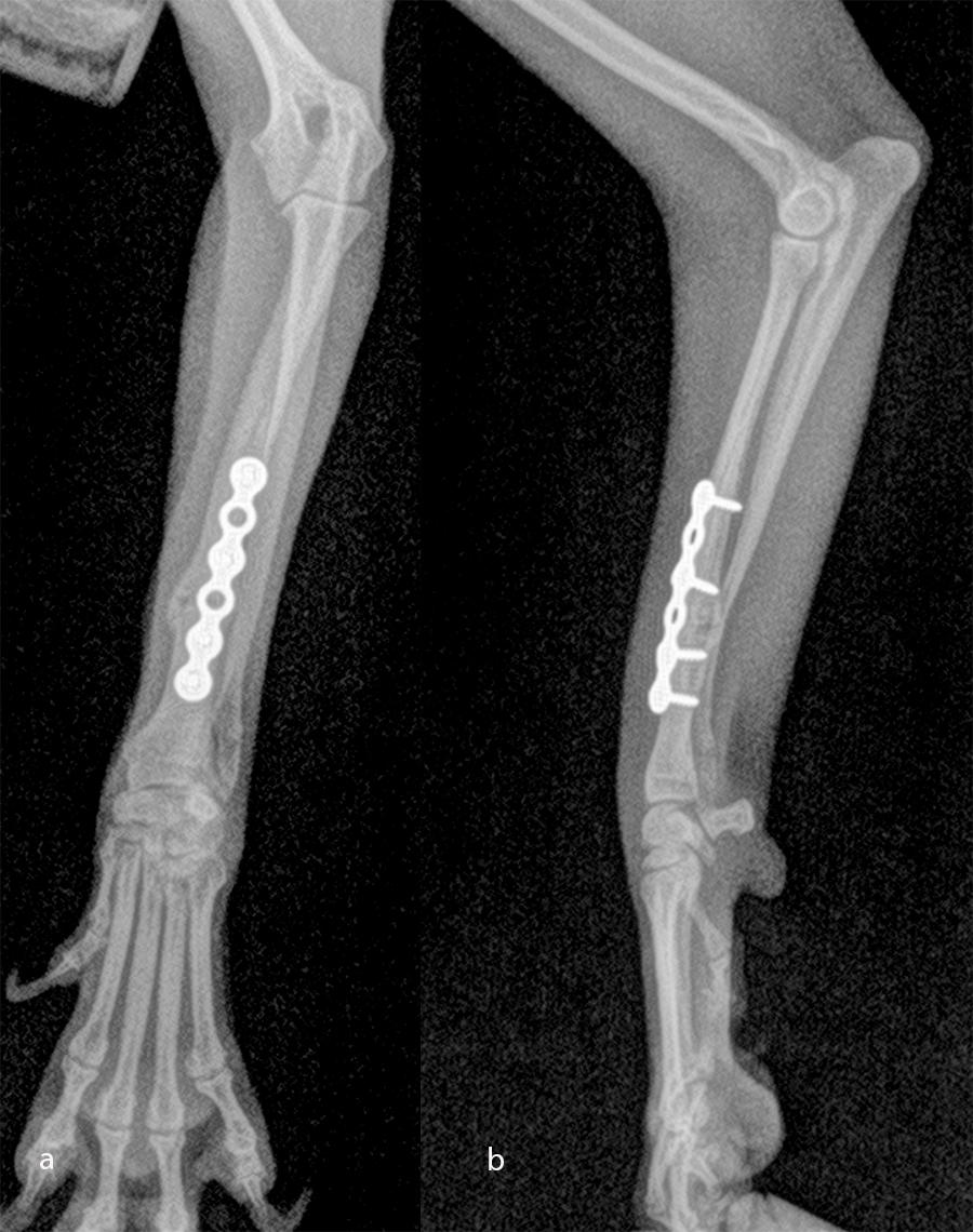 Fig-9 case 1 post op 2