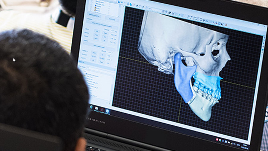 Virtual operation planning