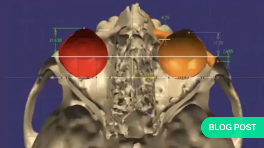 Changing faces, changing lives: Correction of facial defects using patient-matched subperiosteal implants