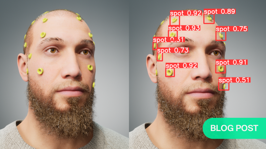 Object detection models trained on synthetic data for surgical navigation image-to-patient registration