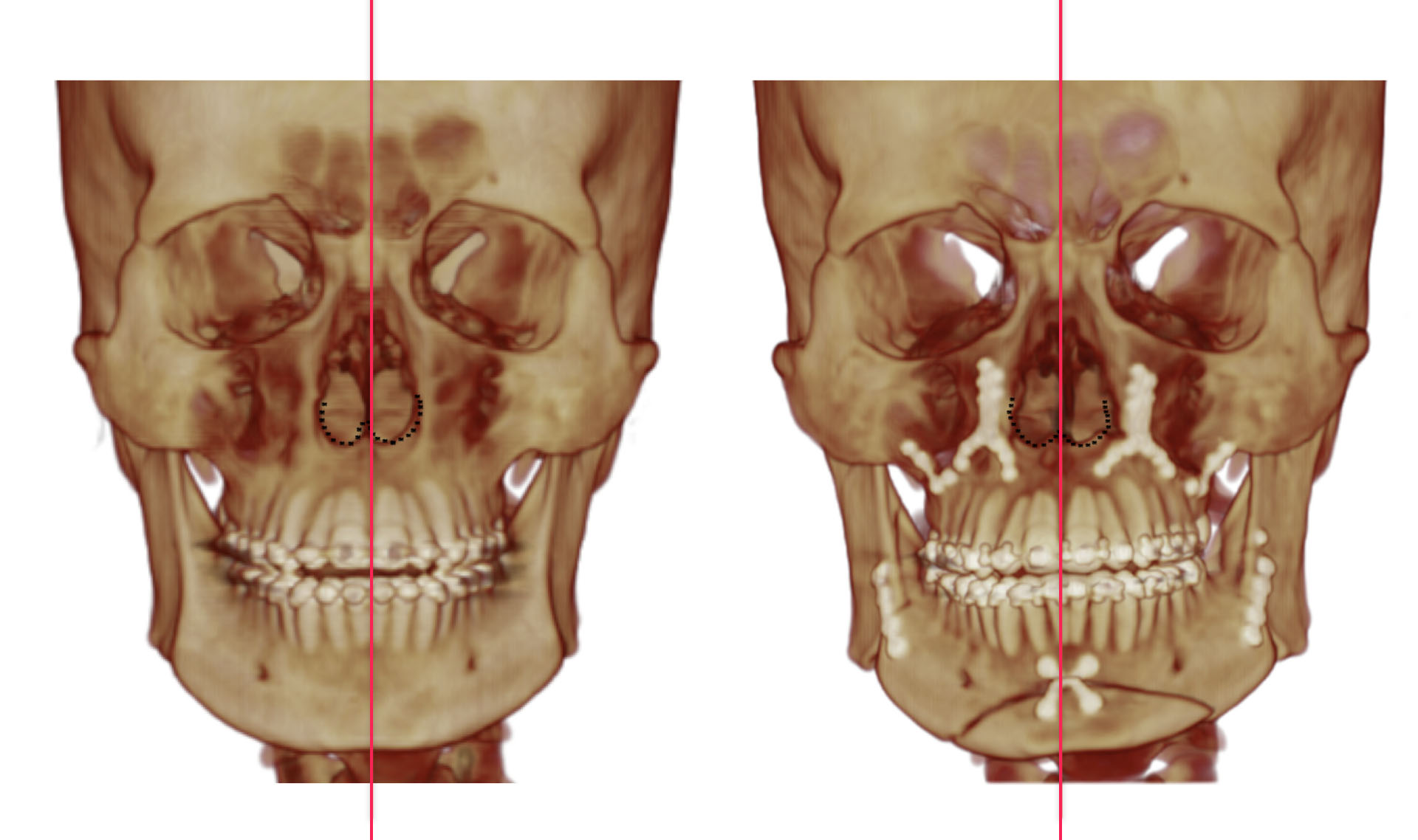 Patient X-ray
