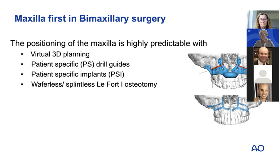 Sequencing in orthognathic treatment