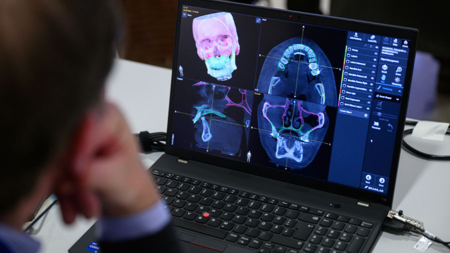 VSP, 3D modeling and AR welcome the new era of personalized CMF surgery