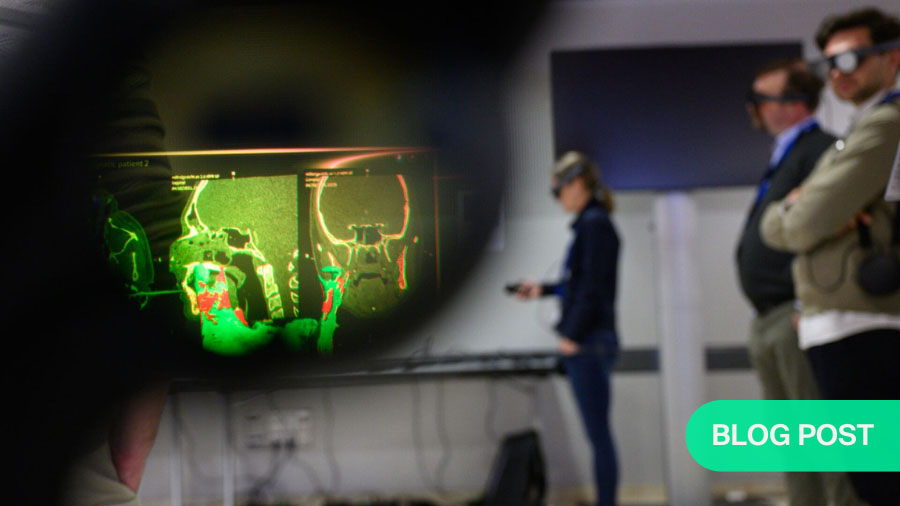 VSP, 3D modeling and AR welcome the new era of personalized CMF surgery