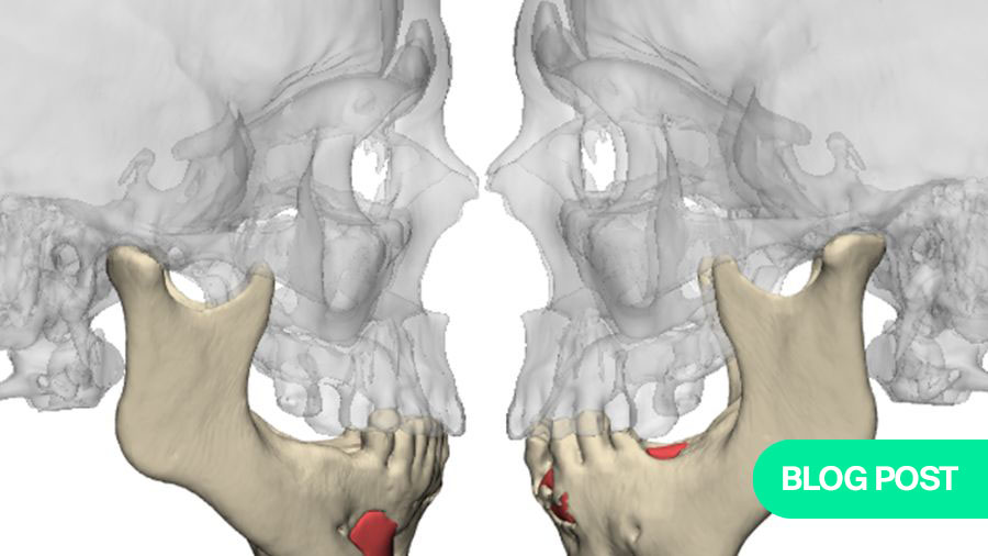 Precision surgery—balancing risk and impact in maxillofacial surgery