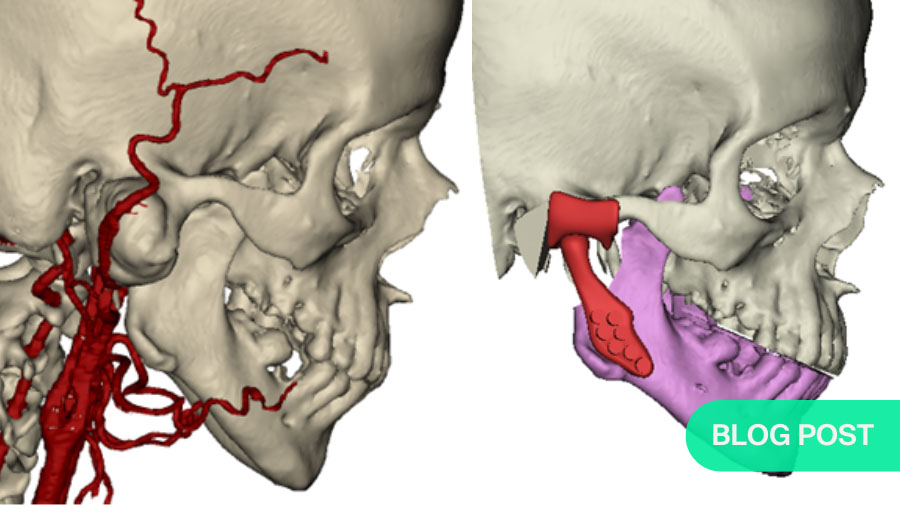 Avoiding complications in TMJ surgery: practical strategies for safer outcomes