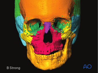AO CMF Midface trauma revised content AO CMF Midface trauma revised content