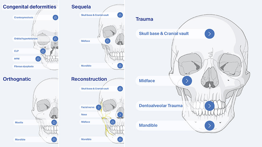 Preview of AO Surgery Reference CMF modules