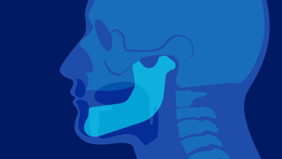 Advancing oral cancer care through Global Oral Cancer Diploma Program