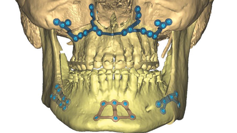 MatrixMIDFACE MatrixMIDFACE