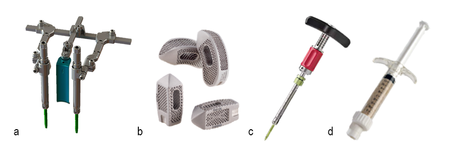 VIPER PRIME™ TLIF Retractor as a key component of the UNLEASH™ MIS TLIF Procedural Suite