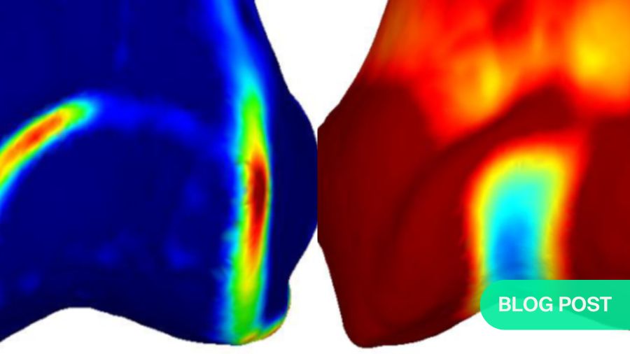 Precision over presumption—why "patellofemoral syndrome" is not an adequate diagnosis