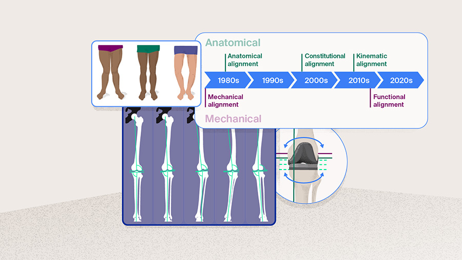 健康・医学 The Art of Limb Alignment, 12th Edition The Art of Limb Alignment | PDF