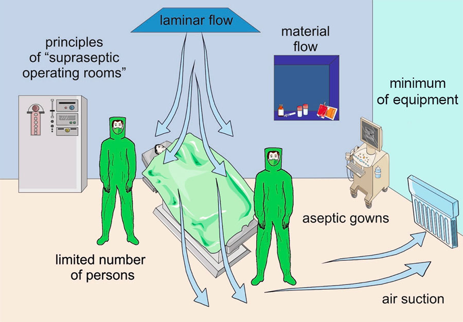 Preventative measures associated with the operating room