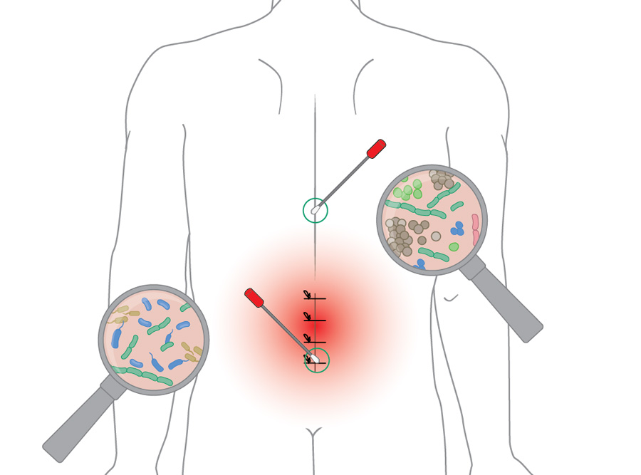 Correlation between the relative abundance of taxa (0–100%) in preoperative samples of skin overlying the surgical site and the anatomical location of the surgical site
