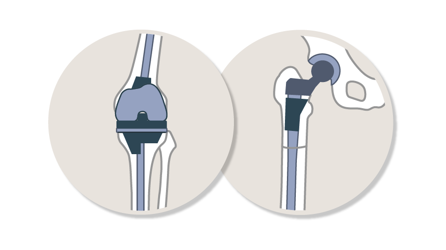AO Recon Curricula_Complex Total Hip and Knee