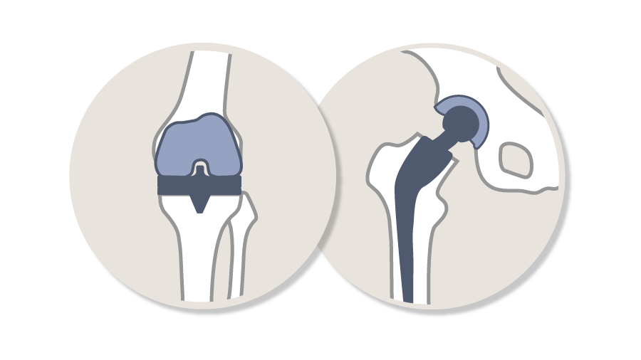 AO Recon Curricula_Principles of Total Hip and Knee