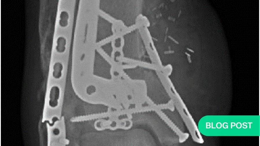 How bacteriophages could revolutionize treatment of fracture related infections