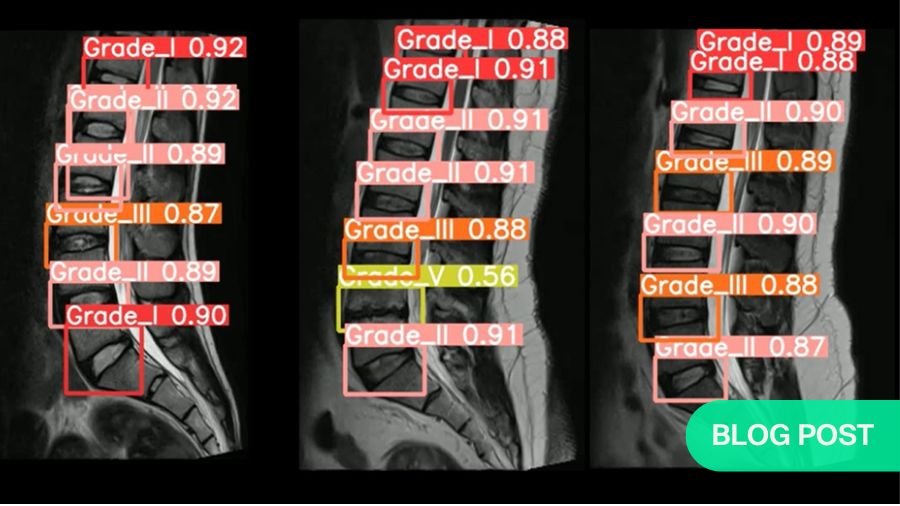 How to start understanding Machine Learning in spine research
