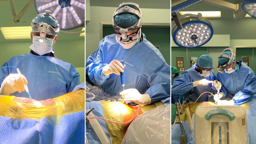 Authors performing lumbar fusion using the Pre-Psoas approach