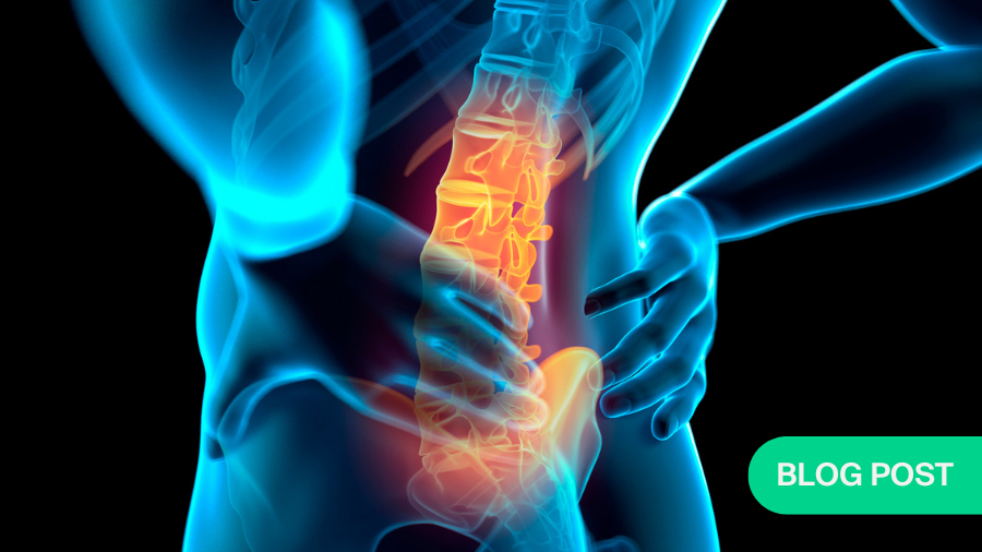 Low back pain