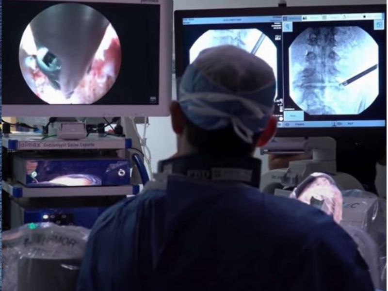 Peter Derman and Minimally invasive techniques for disc herniation surgery