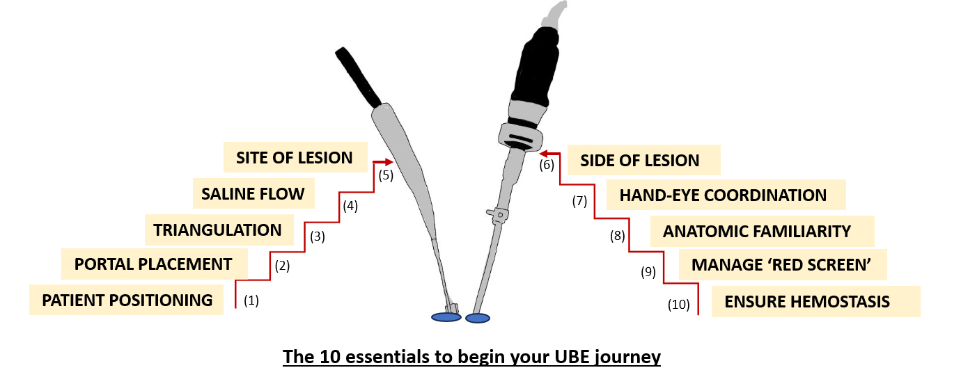 Unilateral Biportal Endoscopy (UBE): 10 essentials for starting your endoscopic journey
