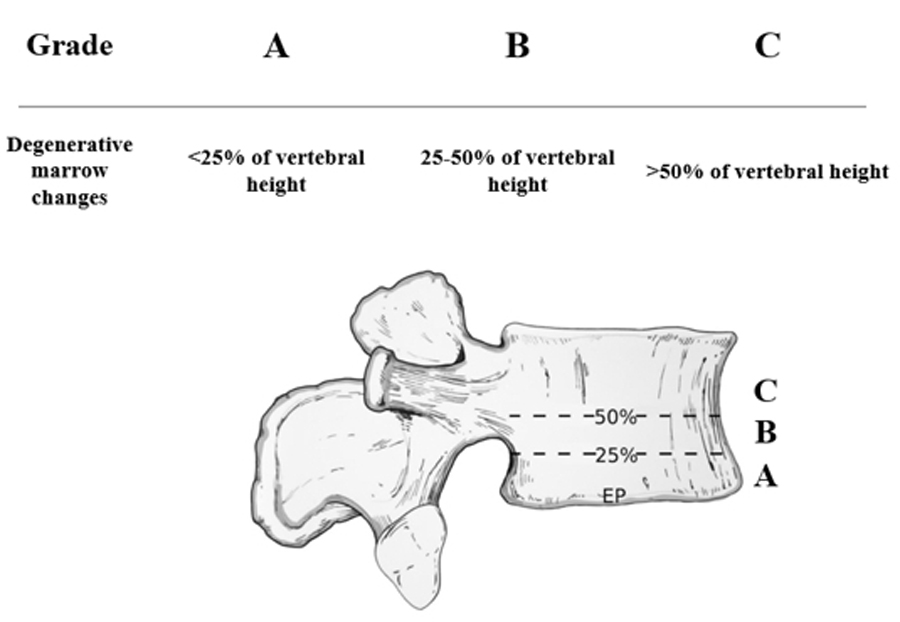 Modic Changes in spine surgery
