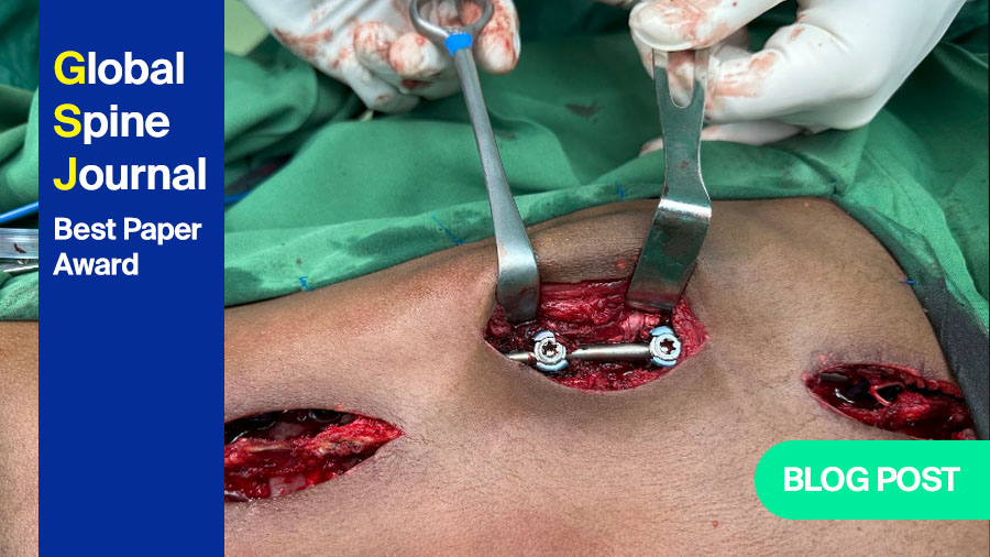 Active Apex Correction (APC): innovative non-fusion technique for Early Onset Scoliosis treatment