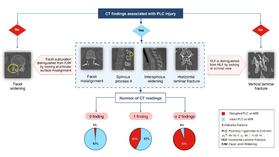 CT findings on PLC injuries