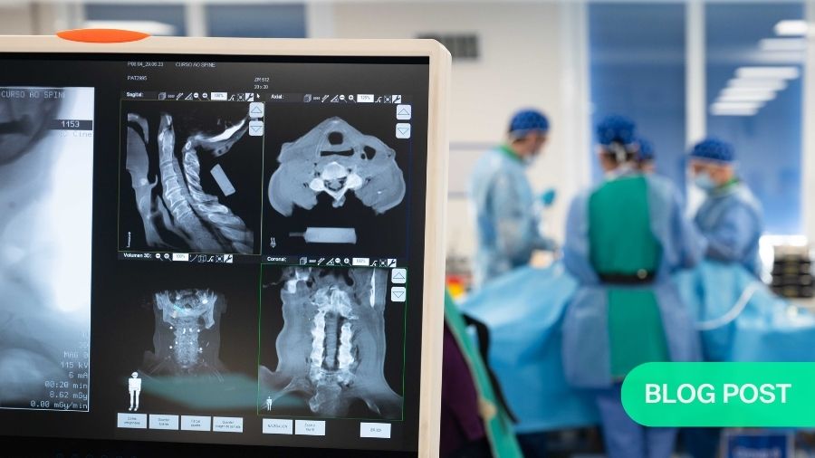 Evolving minimally invasive techniques in posterior cervical spine instrumentation