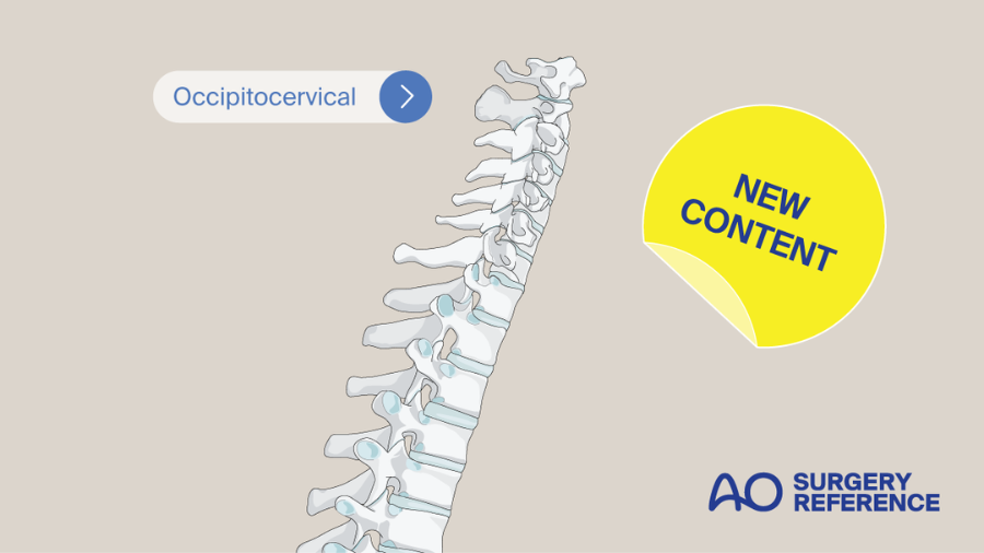 AO Surgery Reference spine section updated with new upper cervical injuries classification