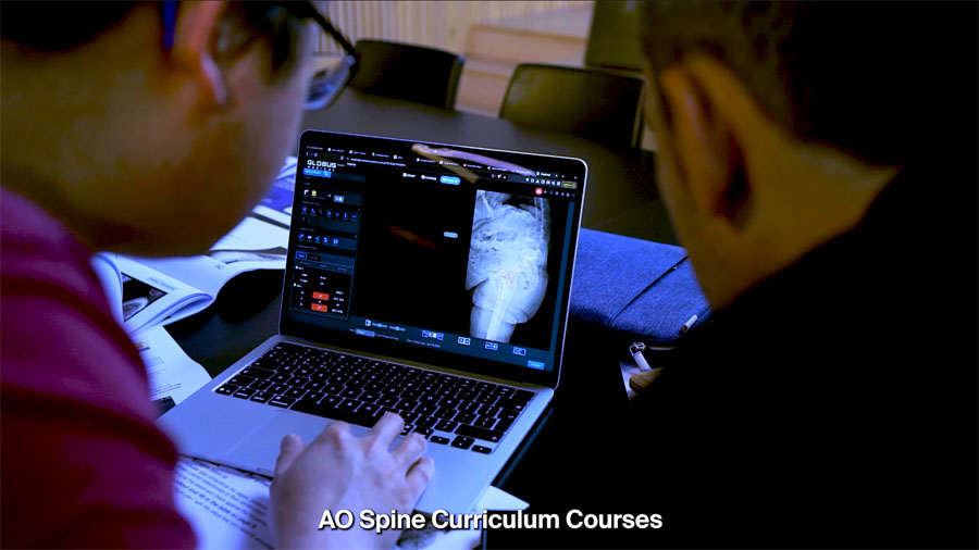 Participants in an advanced AO Spine Deformity Curriculum Course discussing treatment options for complex deformity cases