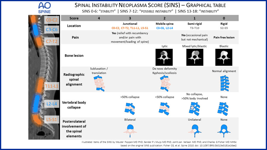 AO Spine Spinal lnstability Neoplastic Score (SINS) Graphical Table AO Spine Spinal lnstability Neoplastic Score (SINS) Graphical Table
