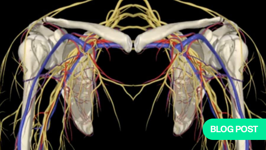 Why proximal humeral fixation often fails: understanding the key pitfalls and how to avoid them