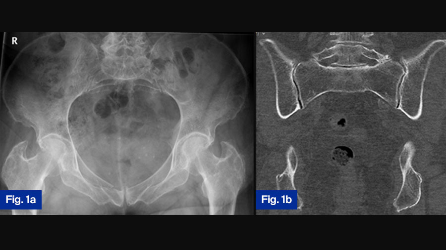 FFP case study 1: 78-year-old female (a and b)