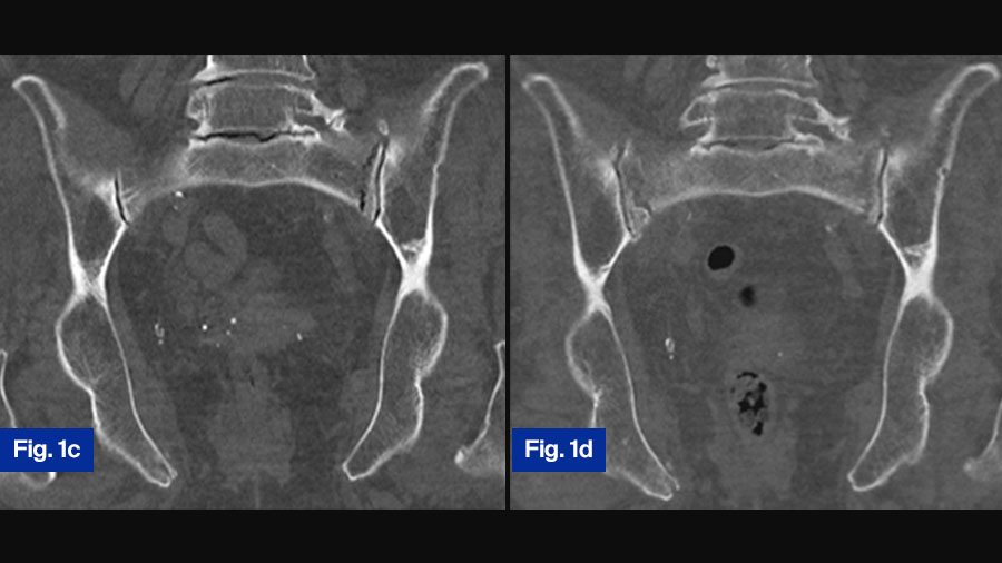 FFP case study 1: 78-year-old female (c and d)