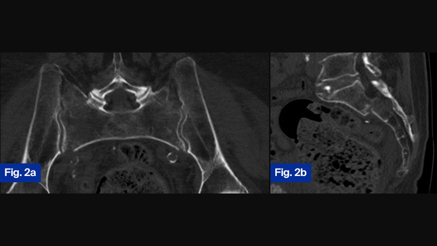 FFP case study 2: 92-year-old female (a and b)