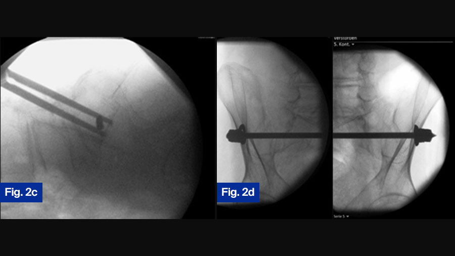FFP case study 2: 92-year-old female (c and d) 