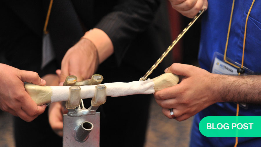 When should plates be used in pediatric fractures? Principles for responsible indication of minimally invasive fixation