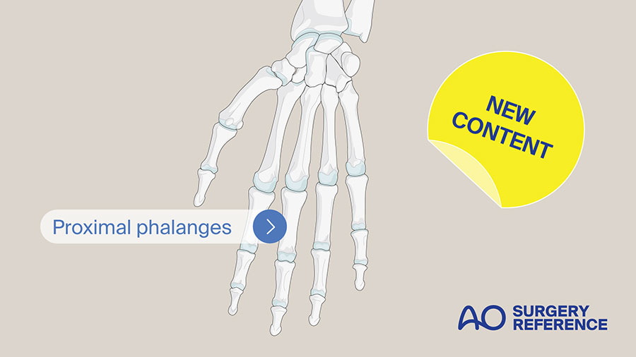 AO Surgery Reference update: Publication of Hand - Proximal phalanges