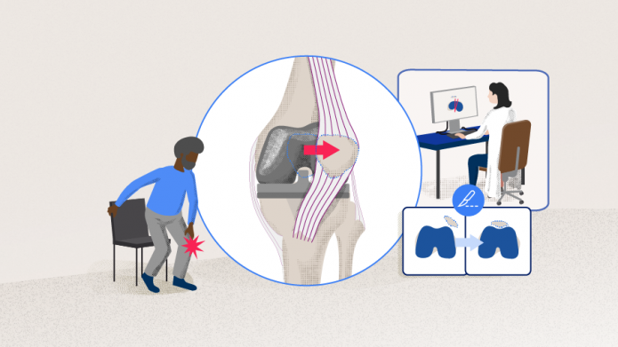AO Recon Surgical Insights
