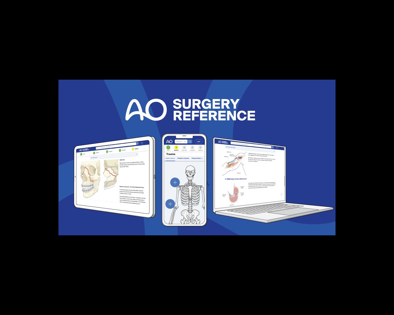Ao Reference Metacarpal Fractures: Avoiding Malunion and Stiffness