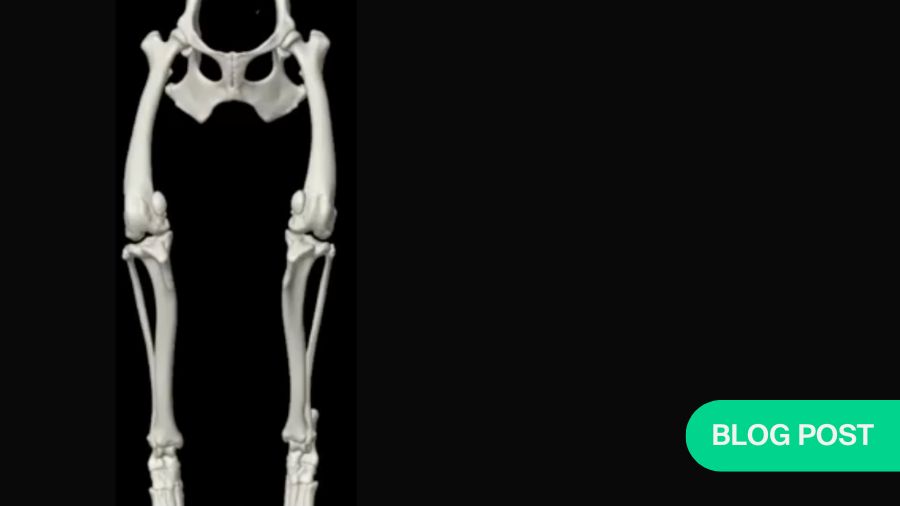 When to consider a Distal Femoral Osteotomy to correct femoral varus—and how to use clinical imaging data to help make the right decision