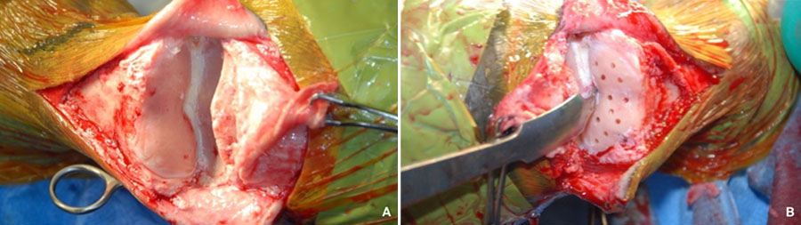 Pastern Arthrodesis in the horse: Current Controversies