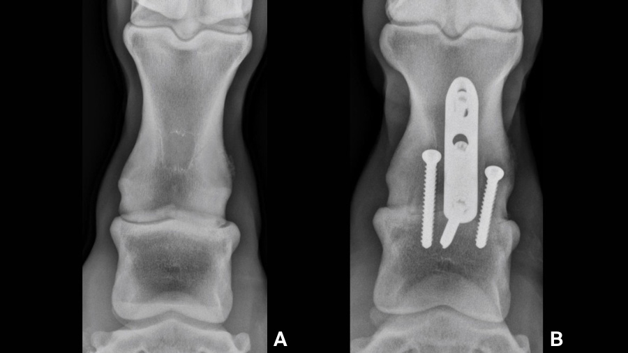 Pastern Arthrodesis in the horse: Current Controversies