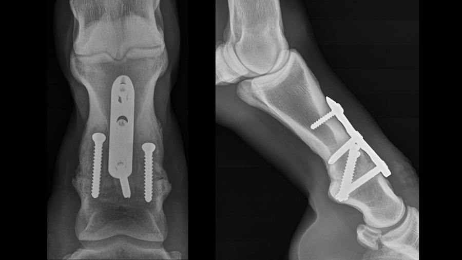 Pastern Arthrodesis in the horse: Current Controversies