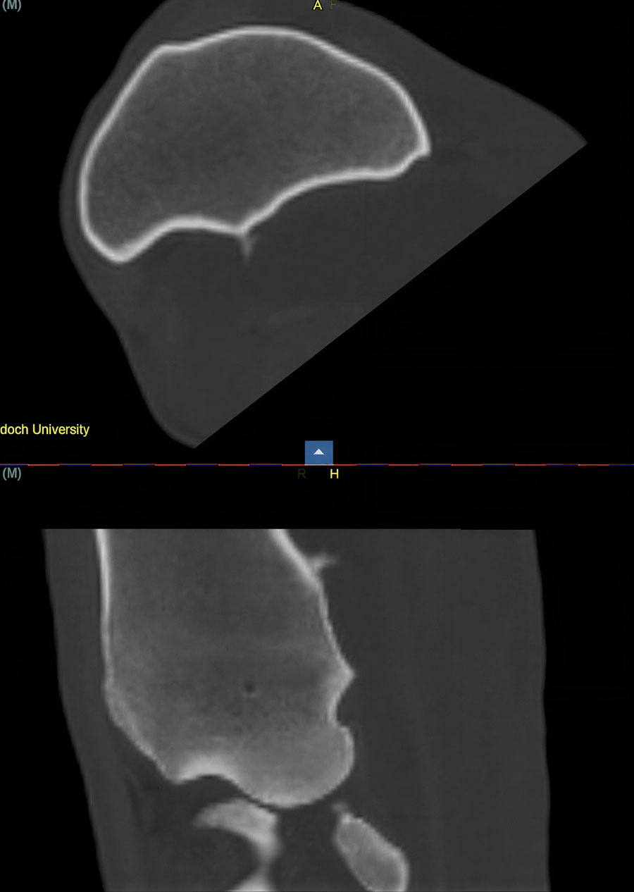 Understanding the physeal spike complex in equine athletes