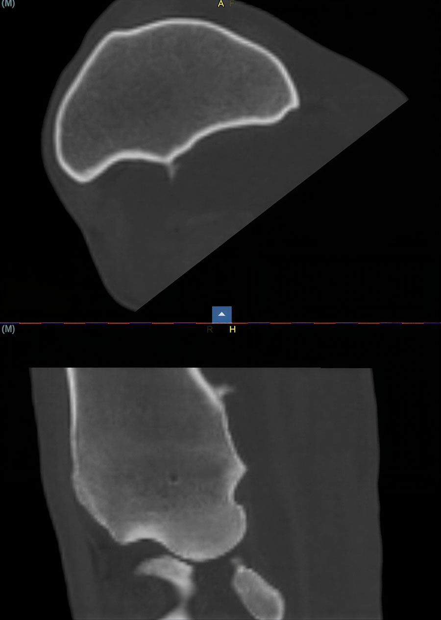 Understanding the physeal spike complex in equine athletes